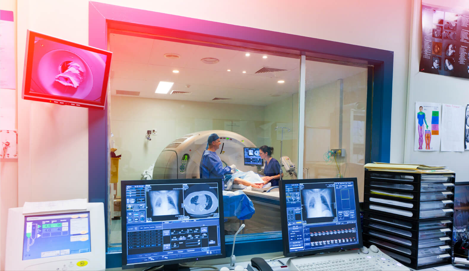 A View of MRI Scans With the Patient, the Doctor and a Nurse in The Background